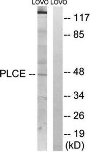 AGPAT5 antibody