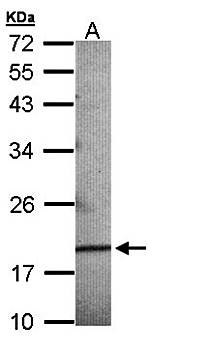 Breast cancer membrane protein 11 precursor antibody