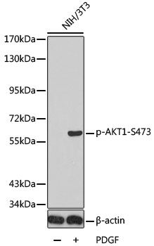 AKT1 (Phospho-S473) antibody
