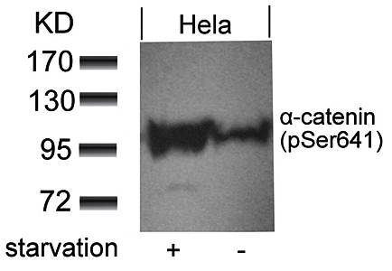 α-catenin (Phospho-Ser641) Antibody