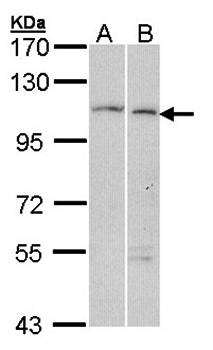 alpha Glucosidase II antibody