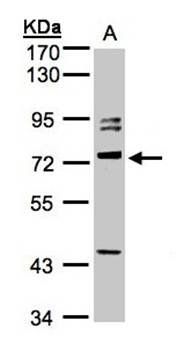 Amphiphysiniphysin isoform 1 antibody