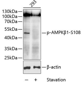 AMPKbeta1 (Phospho-S108) antibody