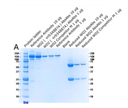 Amyloid beta antibody