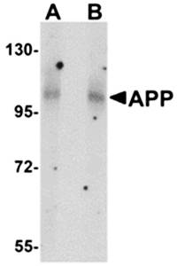 APP Antibody