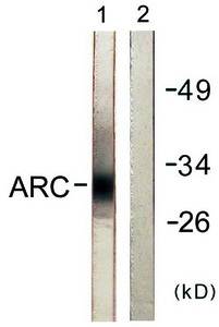 ARC antibody