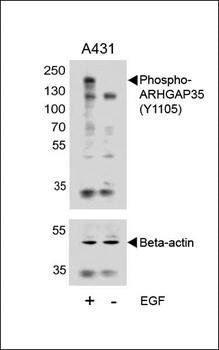 ARHGAP35 antibody