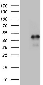 ASB2 antibody