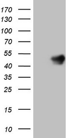 ASB2 antibody