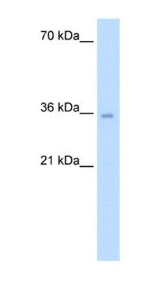 ATIC antibody