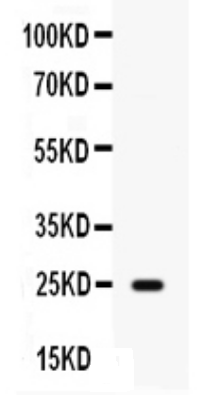 HE4/WFDC2 Antibody