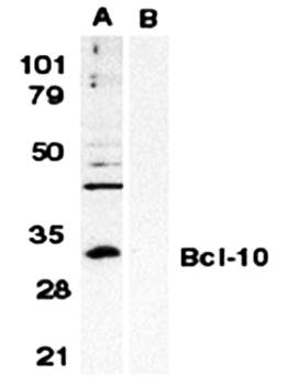Bcl0 Antibody
