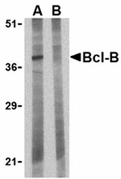 Bcl-B Antibody