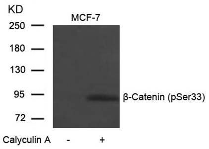 β-Catenin (Phospho-Ser33) Antibody
