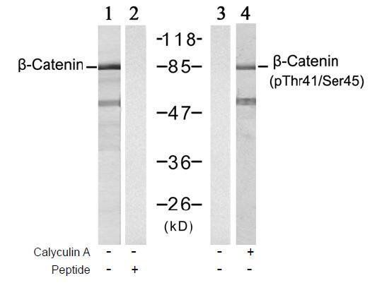 β-Catenin (Phospho-Thr41/Ser45) Antibody