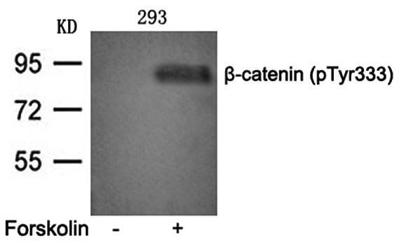 β-catenin (phospho-Tyr333) Antibody