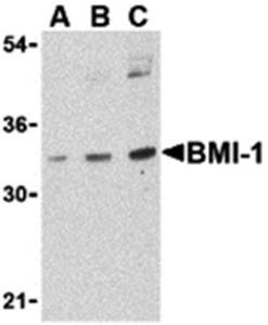 BMI Antibody