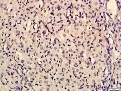 BRCA1 (phospho-Ser1189) antibody
