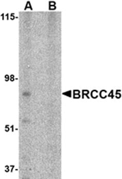 BRCC45 Antibody