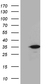 C9orf89 (CARD19) antibody