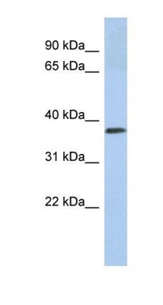 CALR3 antibody
