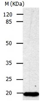 CDKN1A Antibody