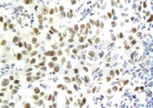 CDKN1A (phospho-Ser130) antibody