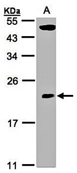 CGI21 antibody