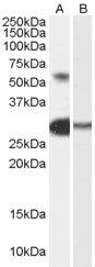 TCFL5 antibody