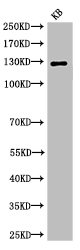 Cleaved-NOTCH2 (D1733) antibody