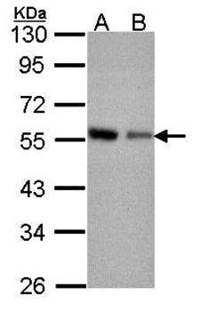 Coronin 3 antibody