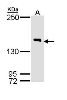 DIP2 homolog B antibody