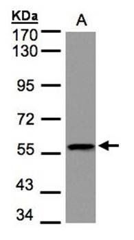 DUSP8 antibody