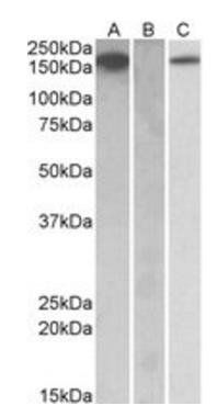 CSF1R antibody
