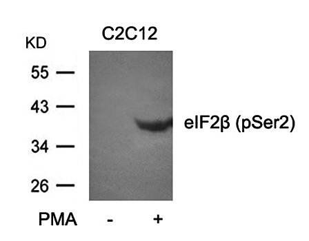 eIF2β (phospho-Ser2) Antibody