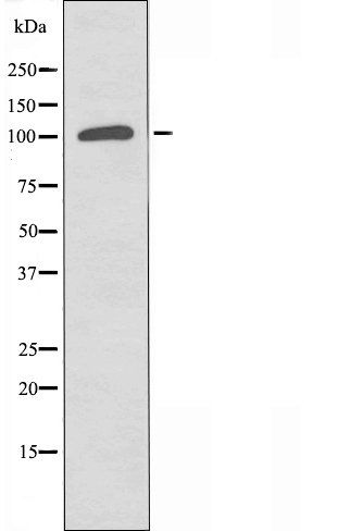 EPHB1 antibody