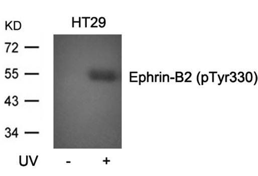Ephrin-B2 (Phospho-Tyr330) Antibody
