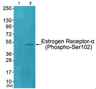 Estrogen Receptor-alpha (phospho-Ser102) antibody