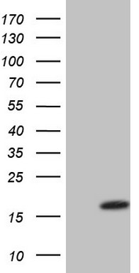Fibronectin (FN1) antibody