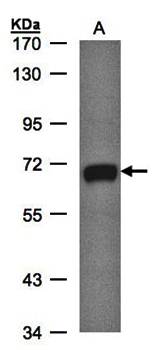 GALNT2 antibody