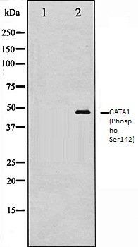 GATA1 (Phospho-Ser142) antibody