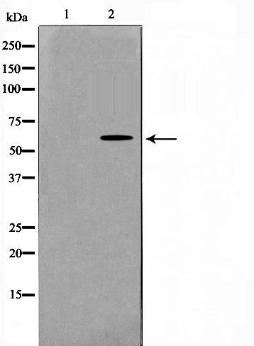 GK antibody