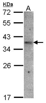 GPR 164 antibody