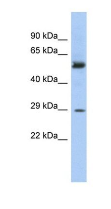 GSTM3 antibody