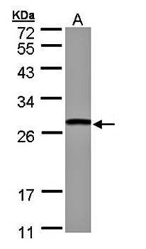 GSTT1 antibody