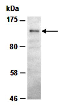 HDAC4 antibody