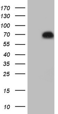 HNF1 beta (HNF1B) antibody