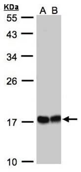 HSPB8 antibody