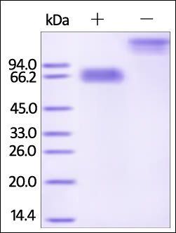 Human Mesothelin / MSLN (296-580) Protein