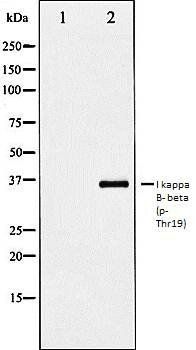 I kappaB- beta (phospho-Thr19) antibody